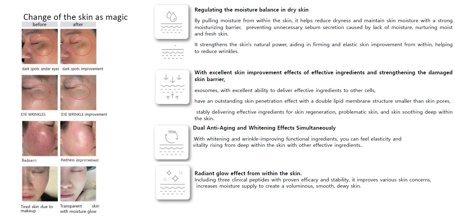 PDX5 Skin Booster Total Solution - product image